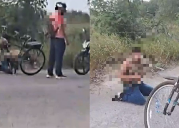 Hombre de 30 años sufre quemaduras en 50% del cuerpo