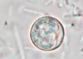 EE. UU. investiga 11,573 posibles casos de ciclosporiasis