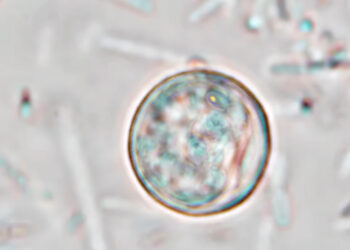 EE. UU. investiga 11,573 posibles casos de ciclosporiasis