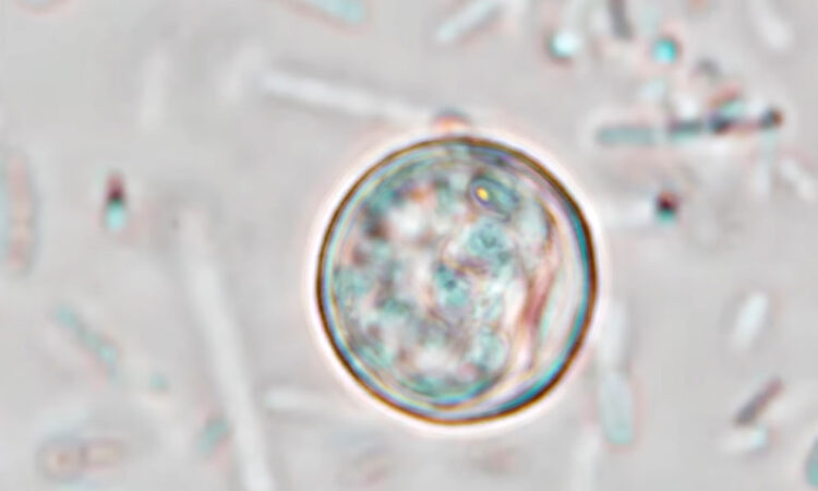 EE. UU. investiga 11,573 posibles casos de ciclosporiasis
