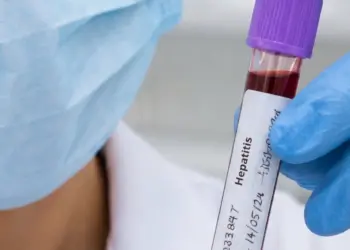 Nuevo Laredo lidera casos de hepatitis C