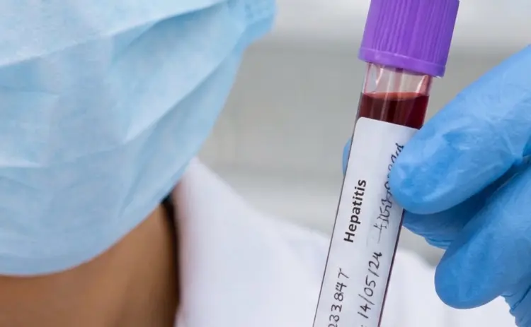 Nuevo Laredo lidera casos de hepatitis C